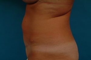 1 yr result