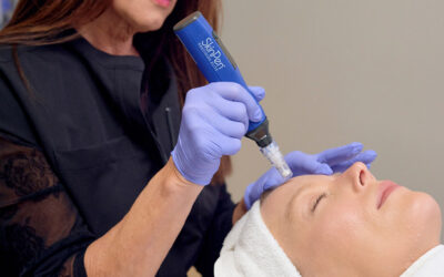 What Collagen Renewal Actually Means: A Closer Look at Microneedling and SkinPen®