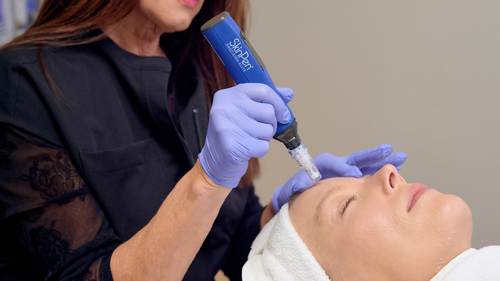 What Collagen Renewal Actually Means: A Closer Look at Microneedling and SkinPen®