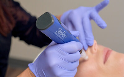 Why SkinPen® Fits Into Your Routine Throughout the Year