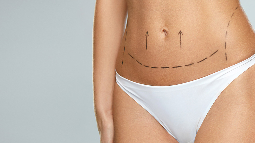 What Actually Changes During a Tummy Tuck? Understanding Skin, Muscle, and Abdominal Contour